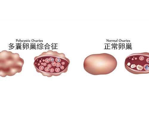 为什么白带像胶水一样黏黏的（白带异味）