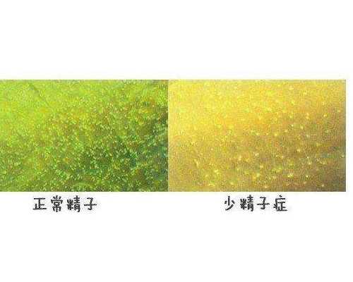 <b>怀孕多久有胎心，什么时候能听到</b>